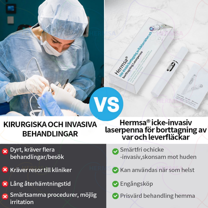 ikke-invasiv laserpeker – fjerning av fødselsmerker og vorter