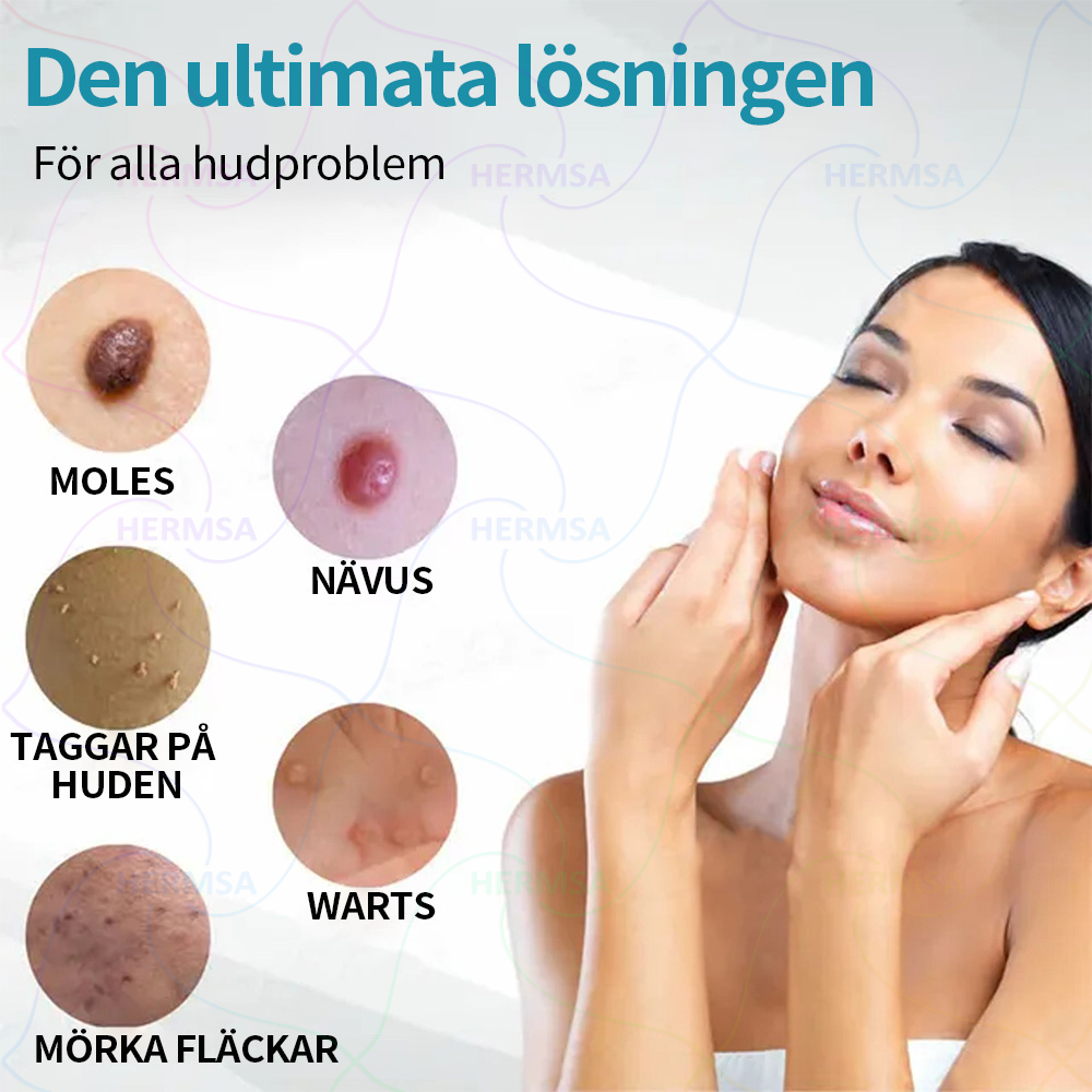 ikke-invasiv laserpeker – fjerning av fødselsmerker og vorter